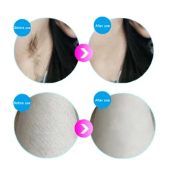 Haarentfernungsgeräte IPL Hautverjüngung Haarentferner Laserverjüngung Hair Remover Schönheitsinstrument Schmerzlos Mit Sonnenbrille 18 Haarentfernungsgeräte IPL Hautverjüngung Haarentferner Laserverjüngung Hair Remover Schönheitsinstrument Schmerzlos Mit Sonnenbrille -Kaufland Verkäufe 3a83b54bd62ed75d3114d601c34abd7c