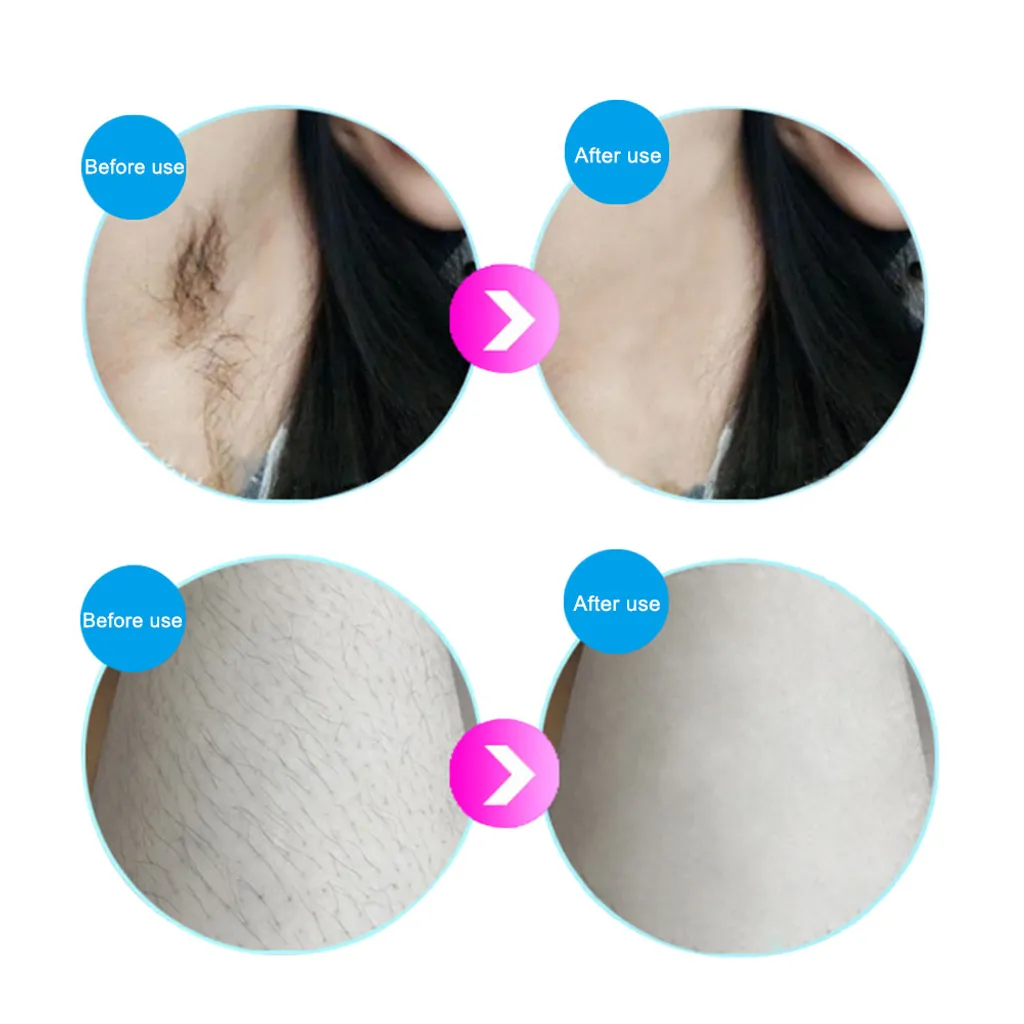 Haarentfernungsgeräte IPL Hautverjüngung Haarentferner Laserverjüngung Hair Remover Schönheitsinstrument Schmerzlos Mit Sonnenbrille 10 Haarentfernungsgeräte IPL Hautverjüngung Haarentferner Laserverjüngung Hair Remover Schönheitsinstrument Schmerzlos Mit Sonnenbrille – Bild 8